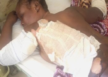 Jealous Ex-Wife Attacks Fiancee of Former Husband with Hot Water in Adamawa